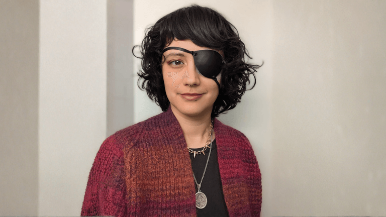 Abigail Roscoe, a disabled artist, wearing an eye patch, showcasing her unique style and resilience.