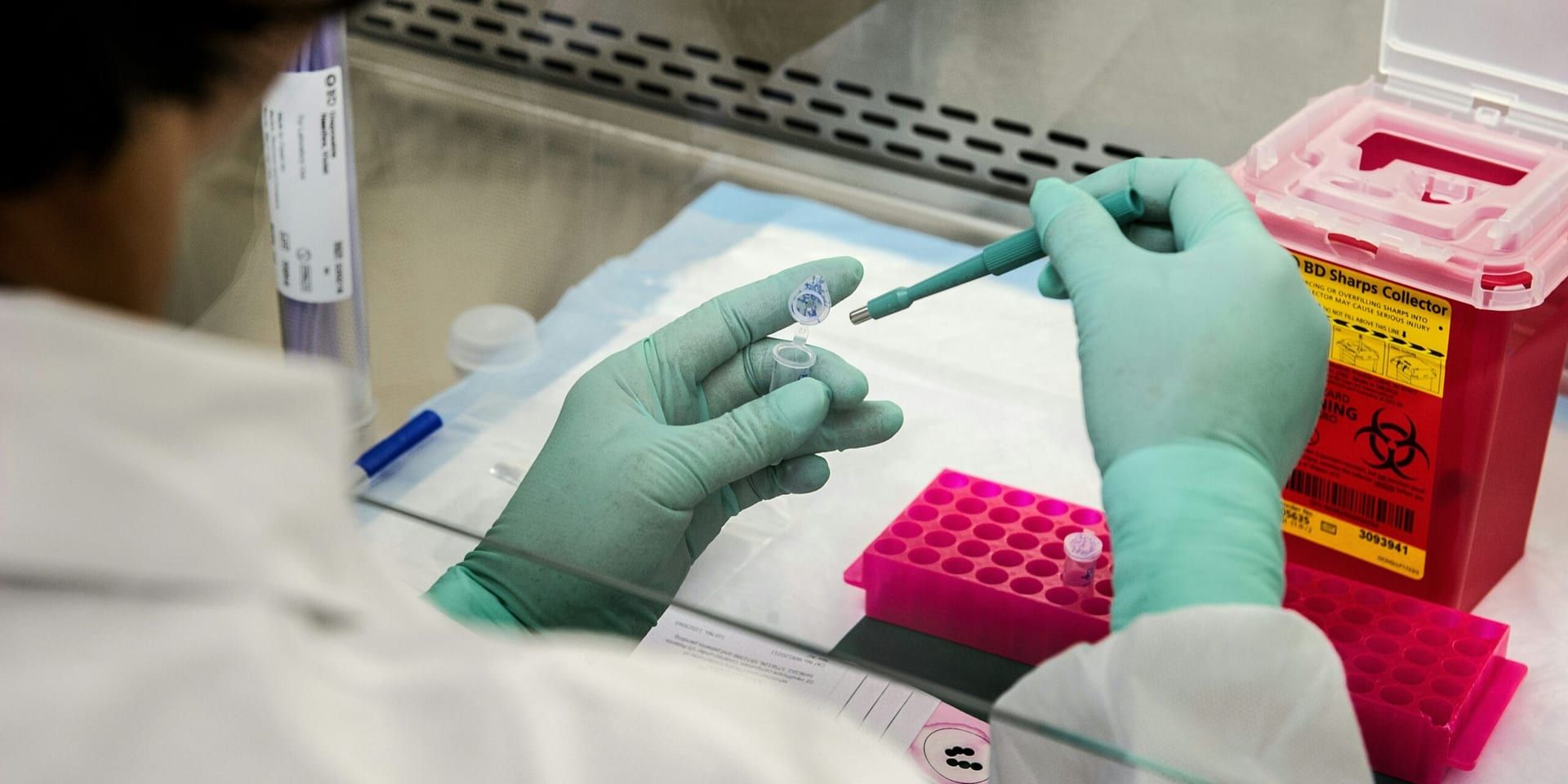New Blood Test Launched to Detect Early‑Stage Pancreatic Cancer