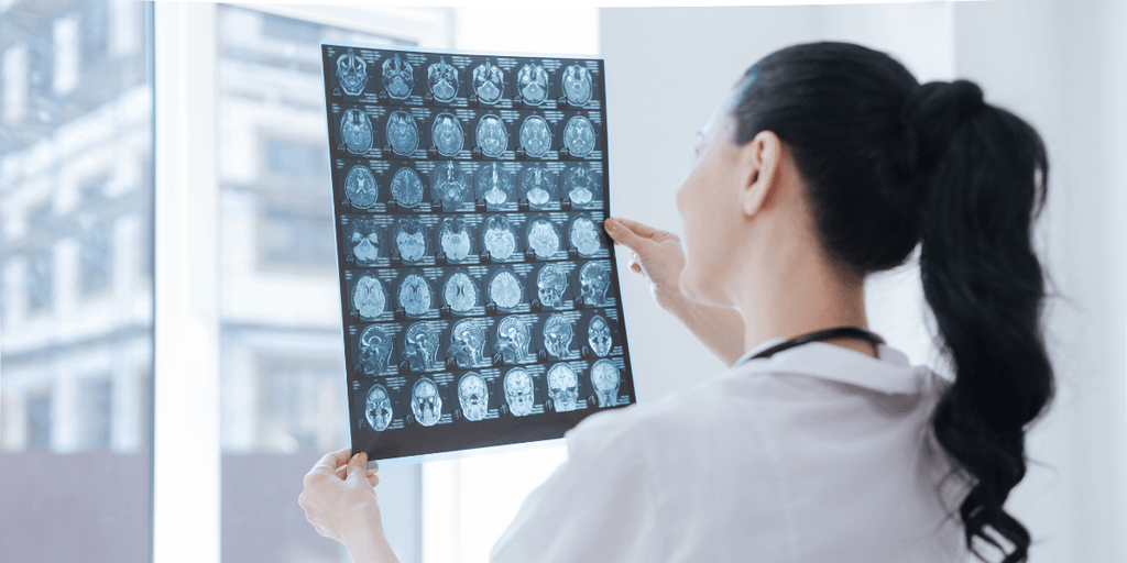 A healthcare professional inspecting a series of brain scans against a window backdrop