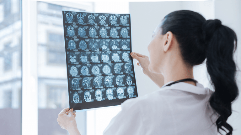 A healthcare professional inspecting a series of brain scans against a window backdrop